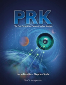 PRK : The Past, Present, and Future of Surface Ablation