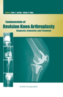 Fundamentals of Revision Knee Arthroplasty : Diagnosis, Evaluation, and Treatment