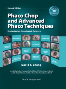 Phaco Chop and Advanced Phaco Techniques : Strategies for Complicated Cataracts, Second Edition