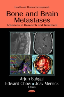 Bone and Brain Metastases: Advances in Research and Treatment