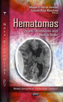 Hematomas : Types, Treatments & Health Risks, Hardback Book Hematomas : Types, Treatments & Health Risks, Hardback Book