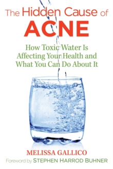 The Hidden Cause of Acne : How Toxic Water Is Affecting Your Health and What You Can Do about It, Paperback Book The Hidden Cause of Acne : How Toxic Water Is Affecting Your Health and What You Can Do about It, Paperback Book