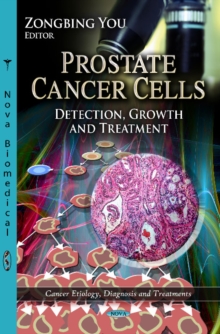 Prostate Cancer Cells : Detection, Growth & Treatment, Hardback Book Prostate Cancer Cells : Detection, Growth & Treatment, Hardback Book