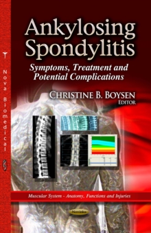 Ankylosing Spondylitis : Symptoms, Treatment and Potential Complications