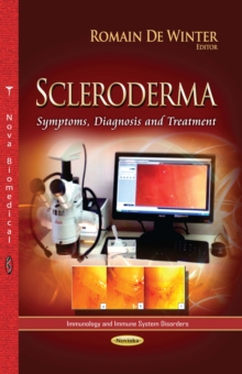 Scleroderma : Symptoms, Diagnosis and Treatment