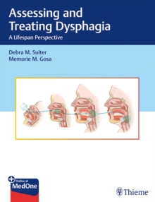 Assessing and Treating Dysphagia : A Lifespan Perspective