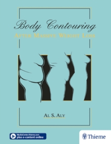 Body Contouring after Massive Weight Loss