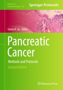 Pancreatic Cancer : Methods and Protocols, Hardback Book Pancreatic Cancer : Methods and Protocols, Hardback Book