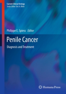 Penile Cancer : Diagnosis and Treatment