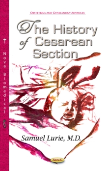 The History of Cesarean Section