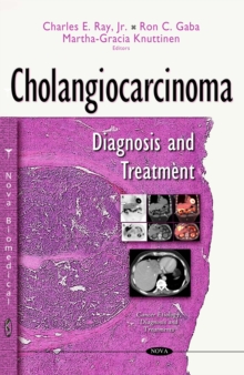 Cholangiocarcinoma : Diagnosis and Treatment