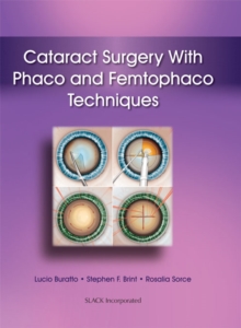 Cataract Surgery With Phaco and Femtophaco Techniques