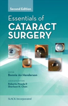 Essentials of Cataract Surgery, Second Edition