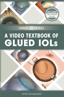 A Video Textbook of Glued IOLs