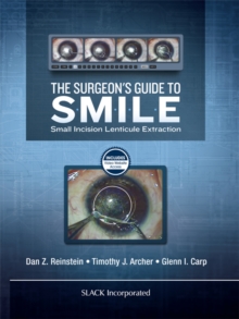 The Surgeon's Guide to SMILE : Small Incision Lenticule Extraction