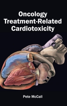 Oncology Treatment-Related Cardiotoxicity