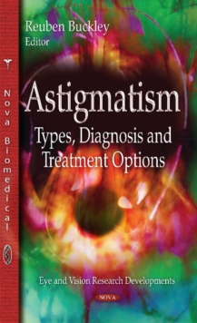 Astigmatism : Types, Diagnosis & Treatment Options, Hardback Book Astigmatism : Types, Diagnosis & Treatment Options, Hardback Book