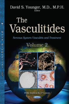 Vasculitidies : Volume 2 -- Nervous System Vasculitis & Treatment, Hardback Book Vasculitidies : Volume 2 -- Nervous System Vasculitis & Treatment, Hardback Book