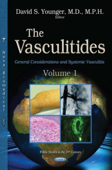 The Vasculitides, Volume 1 : General Considerations and Systemic Vasculitis