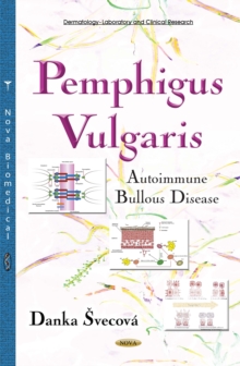 Pemphigus Vulgaris : Autoimmune Bullous Disease