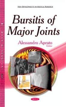 Bursitis of Major Joints, Hardback Book Bursitis of Major Joints, Hardback Book