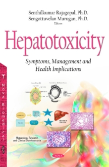 Hepatotoxicity : Symptoms, Management & Health Implications, Hardback Book Hepatotoxicity : Symptoms, Management & Health Implications, Hardback Book