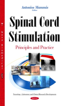 Spinal Cord Stimulation : Principles and Practice