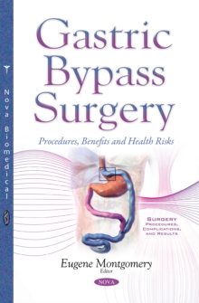 Gastric Bypass Surgery : Procedures, Benefits and Health Risks