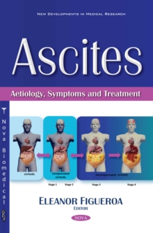 Ascites : Aetiology, Symptoms and Treatment