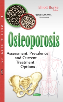 Osteoporosis : Assessment, Prevalence and Current Treatment Options