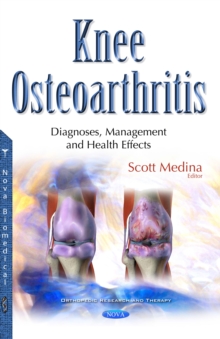 Knee Osteoarthritis : Diagnoses, Management and Health Effects