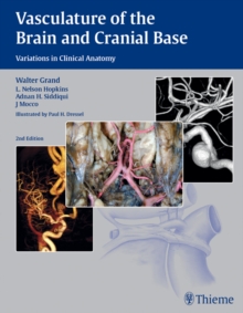 Vasculature of the Brain and Cranial Base : Variations in Clinical Anatomy