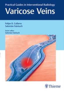 Varicose Veins : Practical Guides in Interventional Radiology