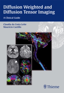 Diffusion Weighted and Diffusion Tensor Imaging : A Clinical Guide