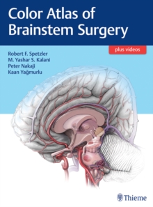 Color Atlas of Brainstem Surgery