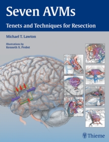 Seven AVMs : Tenets and Techniques for Resection