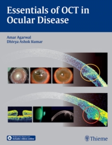 Essentials of OCT in Ocular Disease