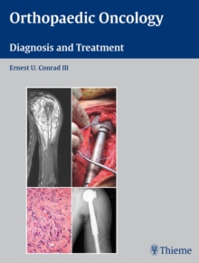 Orthopaedic Oncology : Diagnosis and Treatment