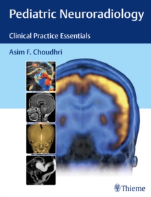 Pediatric Neuroradiology : Clinical Practice Essentials