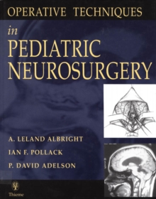 Operative Techniques in Pediatric Neurosurgery