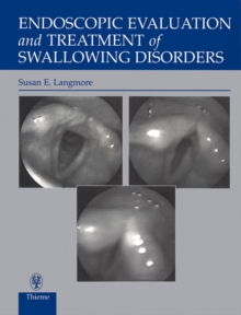 Endoscopic Evaluation and Treatment of Swallowing Disorders