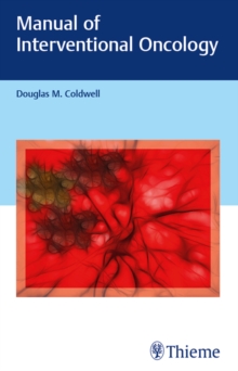 Manual of Interventional Oncology