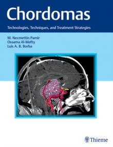 Chordomas : Technologies, Techniques, and Treatment Strategies