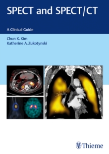 SPECT and SPECT/CT : A Clinical Guide