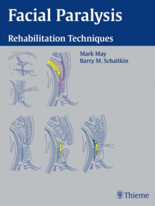 Facial Paralysis : Rehabilitation Techniques