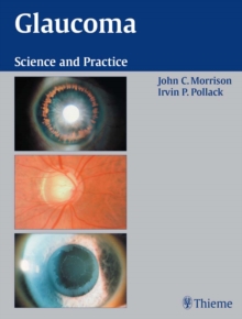 Glaucoma : Science and Practice