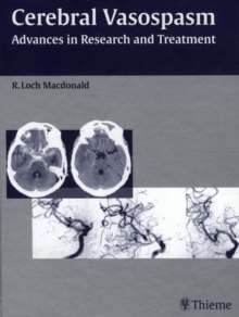 Cerebral Vasospasm : Advances in Research and Treatment