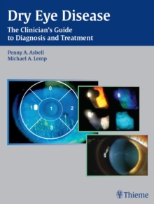 Dry Eye Disease : The Clinician's Guide to Diagnosis and Treatment