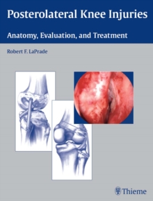 Posterolateral Knee Injuries : Anatomy, Evaluation, and Treatment