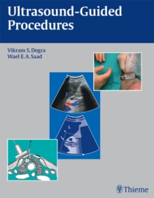 Ultrasound-Guided Procedures